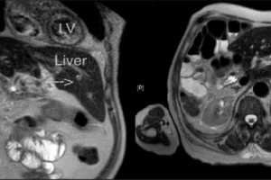 간,담낭,췌장 질환의 진단과 검사(Hepato, Biliary, and Pancreatic Diagnostic Tests)