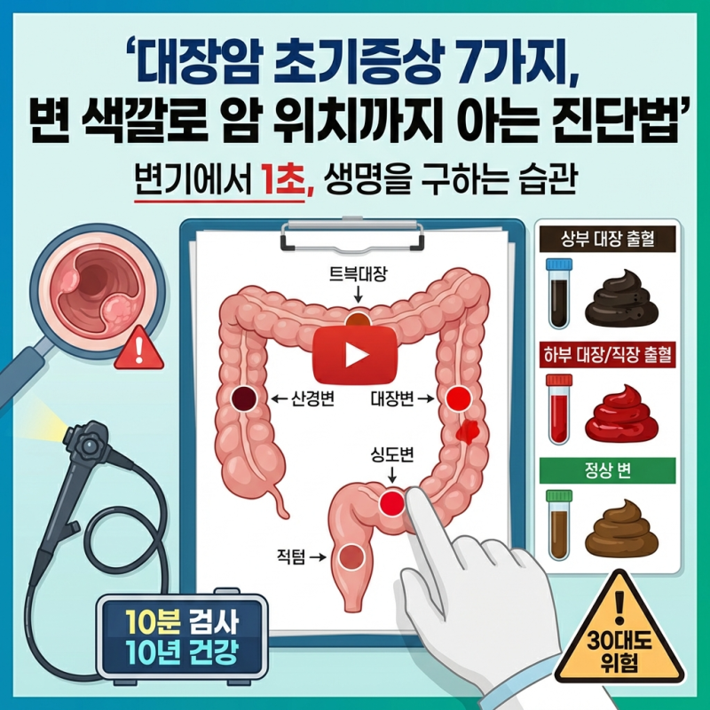 대장암 초기증상 7가지, 변 색깔로 암 위치까지 아는 진단법